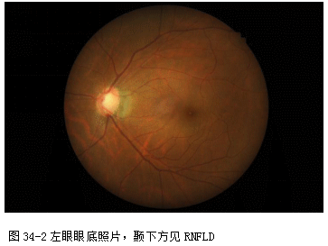 ZY016_175_3.gif